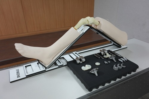사진: 3세대 디자인 인공관절 맞춤형 디자인